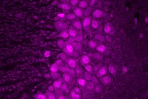 A new method lets researchers visualize messenger RNA translation across different brain cell types. In this image, CA3 pyramidal neurons of the mouse hippocampus glow magenta, indicating especially high rates of protein production